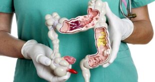 سرطان کولورکتال: آمار و نگرانی ها